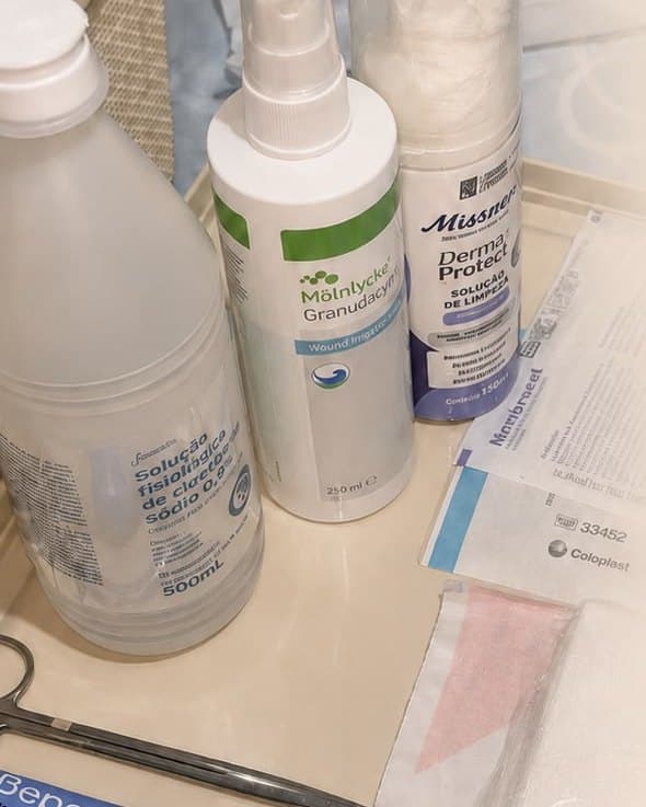 Soluções de limpeza, coberturas estéreis e instrumentais dispostos sobre a bandeja do curativo.