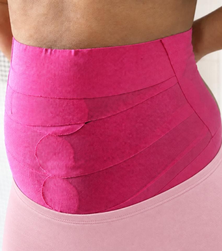Abdômen de uma paciente envolvido por fitas rosa de taping.