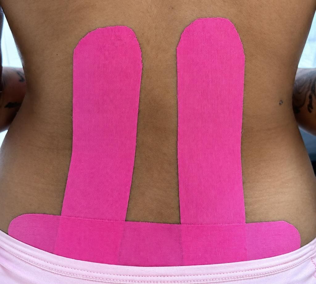 Costas de uma paciente com fitas rosa de taping na região lombar, para conforto lombar e postural.