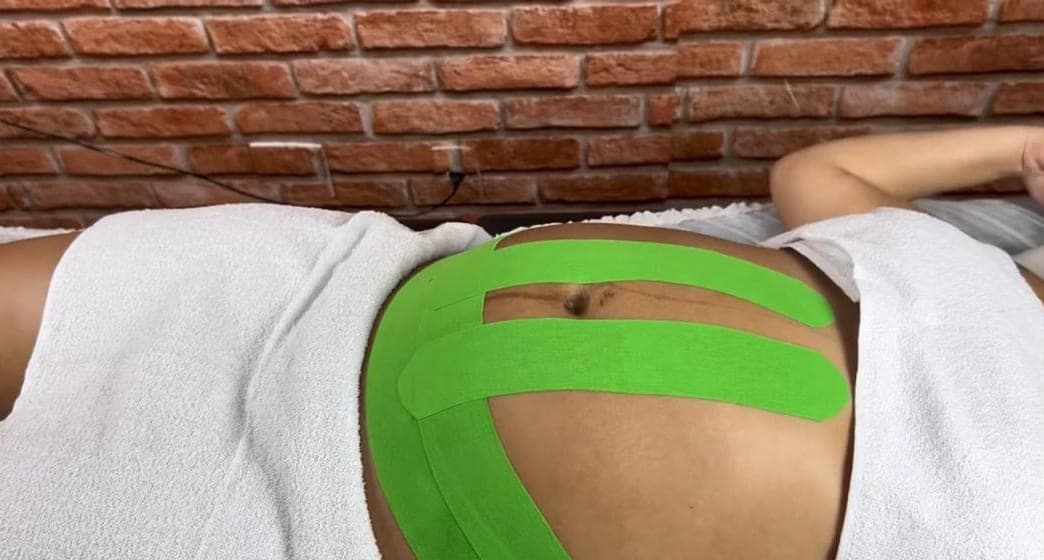 Barriga de gestante com fitas verdes de taping aplicadas em faixas, dando suporte ao abdômen.